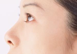 最新2025年版：黒アザに効果的なレーザー治療の全てと対策ガイド